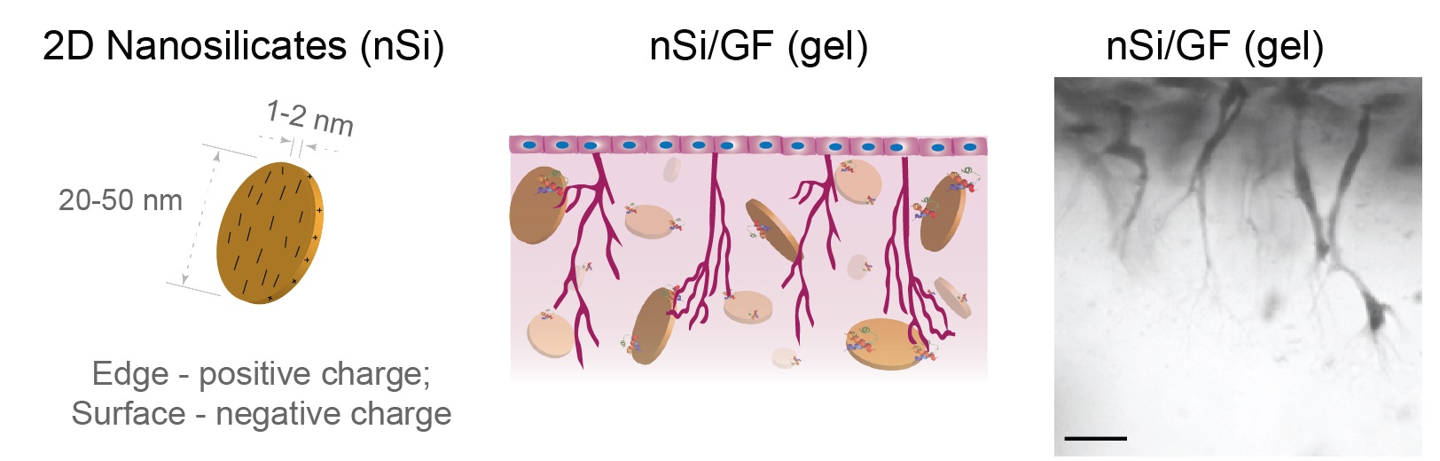 angiogenesis-fig1